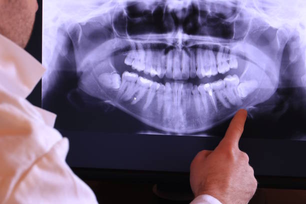 Best Emergency Dental Extractions in Soh Ogden, UT