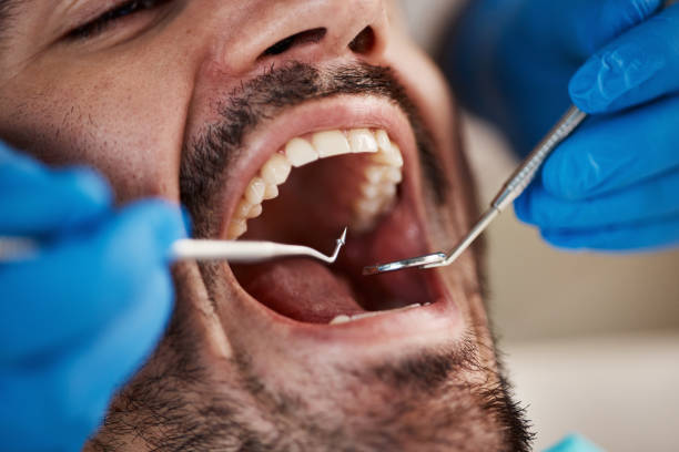 Best Pediatric Emergency Dentist in Soh Ogden, UT